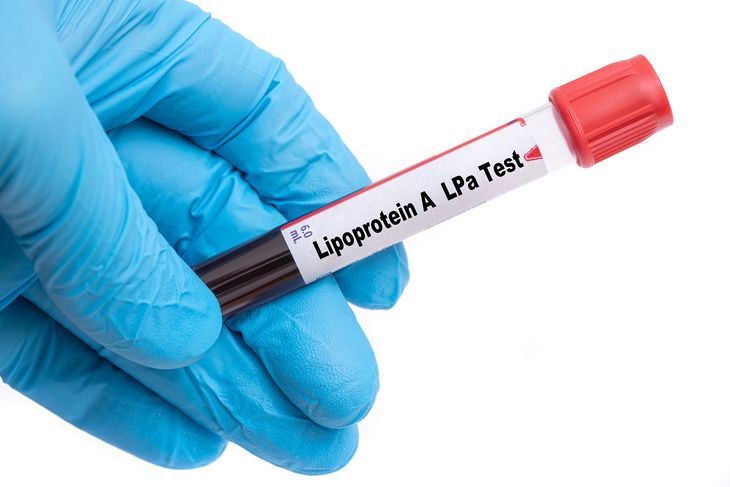 Lipoproteiny odgrywają kluczową rolę w transportowaniu lipidów wewnątrz organizmu, w tym cholesterolu i triglicerydów / Fot. Adobe Stock