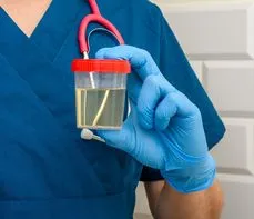 Kolory moczu – co oznacza ciemnopomarańczowy, a co zielony?