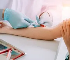 Homocysteina – badanie, normy, homocysteina a cholesterol
