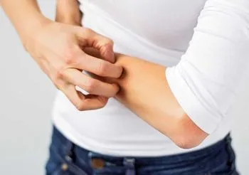 Kobieta drapie skórę na ręce ze względu na dermatillomanię.