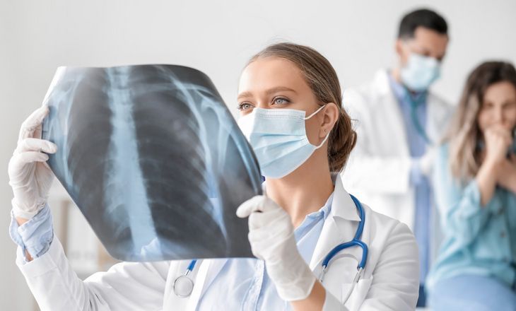 Rozedmę płuc rozpoznaje się dzięki badaniu rentgenowskiemu. Ocena objawów (duszność, świszczący oddech czy kaszel) nie wystarczy do zdiagnozowania choroby. Fot. Adobe Stock. 