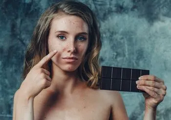 Dziewczyna z trądzikiem i czekoladą