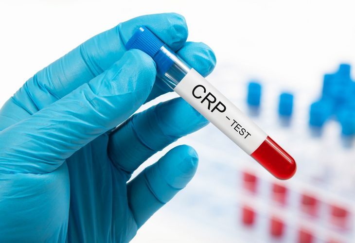CRP, czyli białko C-reaktywne – co to jest, kiedy wykonywać badania CRP i co oznaczają przekroczone normy?