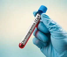 Chromogranina (CgA) – na czym polega badanie? Normy, wskazania, przygotowanie