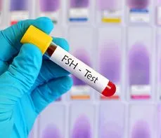 FSH (folikulotropina) – na czym polega badanie hormonu folikulotropowego? Normy, wskazania, przygotowanie