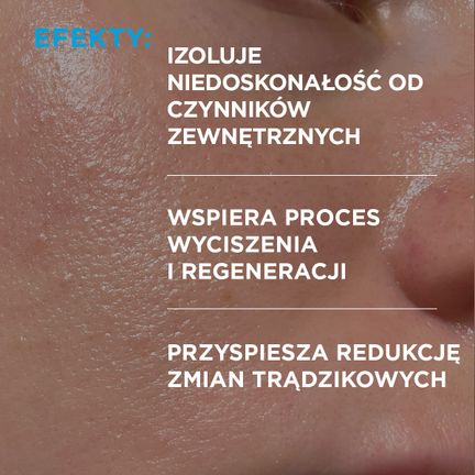 Idee Derm, żel punktowy na wypryski, 15 ml - 5902082214786