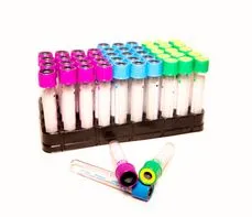 Hemoglobina – na czym polega badanie? Normy, wskazania, przygotowanie