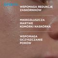 Idee Derm, serum przeciwtrądzikowe z kwasami, 30 ml - 5902082214793
