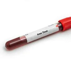 Żelazo (Fe) – badanie i jego przebieg. Normy, wskazania. Kiedy należy wykonać badanie i jak interpretować wynik?