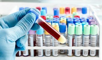 Proste badanie wykrywa 8 rodzajów raka. Przełom w diagnostyce nowotworów?