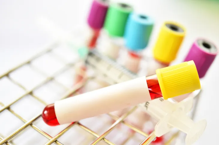 Krzywa insulinowa – na czym polega badanie? Normy, wskazania, przygotowanie