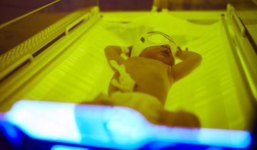 Żółtaczka u noworodka - przyczyny, objawy i leczenie