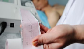 Choroba wieńcowa – co trzeba o niej wiedzieć