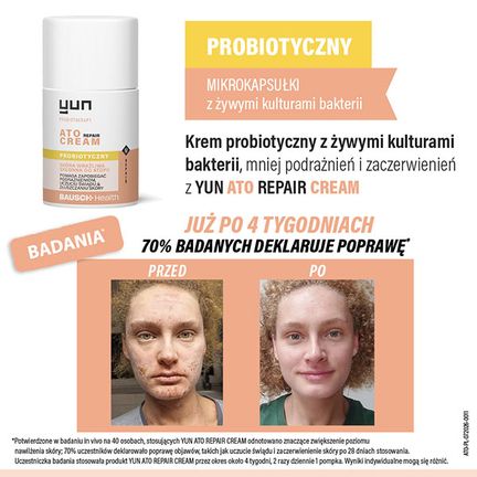 Yun Ato Repair Cream, krem probiotyczny, 50 ml  - KREM