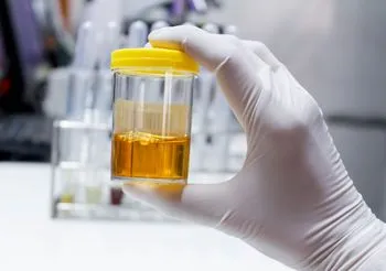 Posiew moczu wymaga wykorzystania jałowego pojemnika. Czas oczekiwania na wyniki wynosi zazwyczaj od 3 do 9 dni roboczych. 
