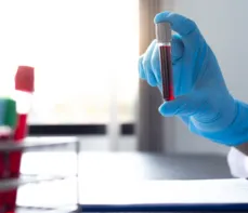 Osteokalcyna – na czym polega badanie? Normy, wskazania, przygotowanie