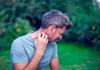 Objawy nietolerancji histaminy są podobne do objawów alergii. Może wystąpić na przykład świąd.