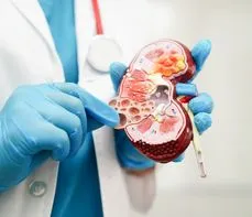 Oznaczenie kreatyniny  – na czym polega badanie? Normy, wskazania, przygotowanie