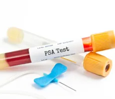 Badanie prostaty oraz antygenu PSA — na czym polega i kiedy je wykonać?