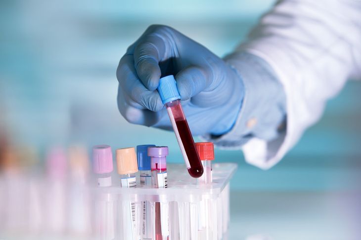 Oznaczanie stężenia mocznika w surowicy krwi jest badaniem przydatnym w diagnozie funkcji nerek i szeregu schorzeń metabolicznych / Fot. Adobe Stock