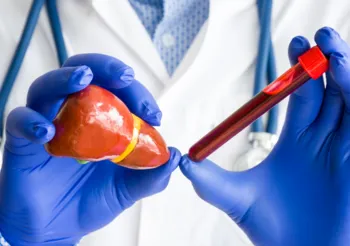 Antygen CA 19-9 to substancja, której pojawienie się we krwi świadczy o poważnych problemach zdrowotnych. /Fot. Adobe Stock