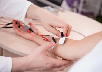 EMG to badanie pozwalające na ocenę prawidłowości funkcjonowania układu mięśniowego i przewodnictwa nerwowego, przy zastosowaniu elektrycznej stymulacji. /Fot. Adobe Stock