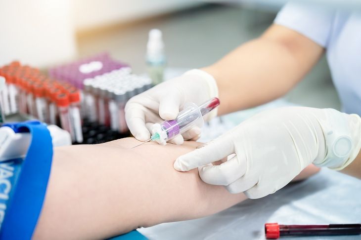 Niskie stężenie IgE wskazuje na to, że na terenie organizmu nie toczy się reakcja alergiczna / Fot. Adobe Stock
