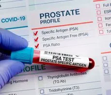 Swoisty antygen gruczołu krokowego (PSA) – na czym polega badanie? Normy, wskazania, przygotowanie, interpretacja wyników