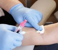 Fosfor (P) – na czym polega badanie poziomu tego pierwiastka? Normy, wskazania, przygotowanie