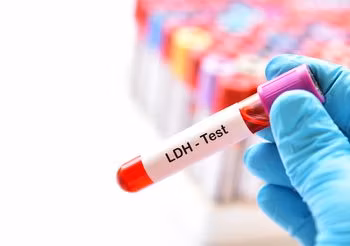 Dehydrogenaza mleczanowa (LDH) jest enzymem odgrywającym duże znaczenie w procesach energetycznych organizmu, głównie w syntezie energii. /Fot. Adobe Stock