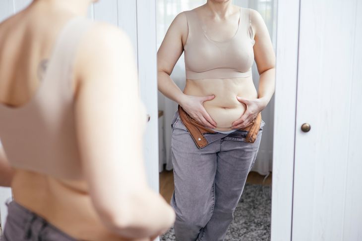 Rozejście się mięśnia prostego brzucha. 