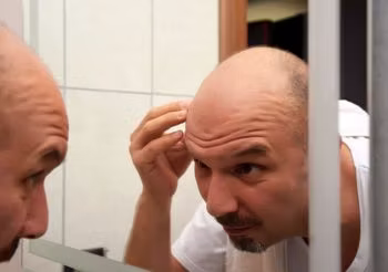 łysy mężczyzna przegląda się w lustrze