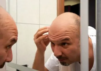 łysy mężczyzna przegląda się w lustrze
