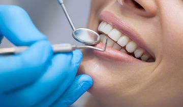 Hiperdoncja. Zęby nadliczbowe to nie tylko defekt estetyczny