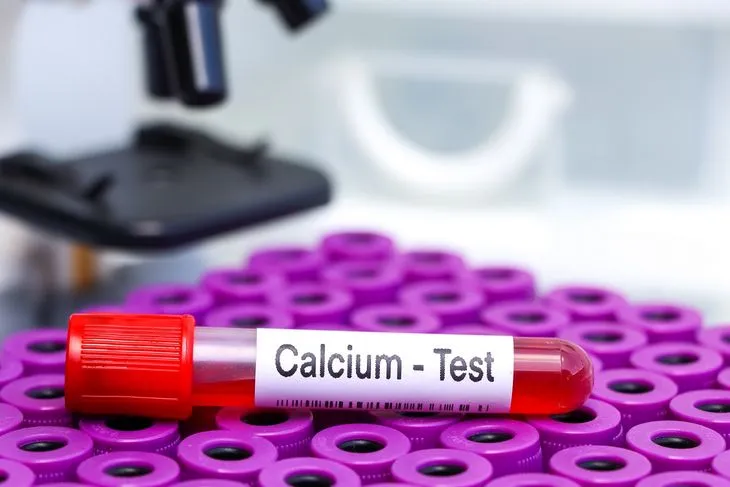 Badanie wapnia całkowitego powinno być wykonywane na czczo / Fot. Adobe Stock