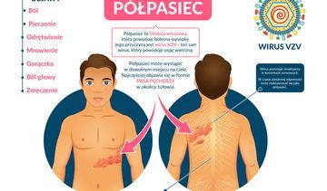 Półpasiec – objawy, leczenie. Jak boli półpasiec, czy jest zaraźliwy?
