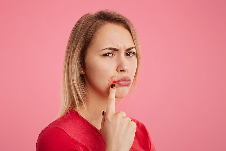 Młoda kobieta niezadowolona wskazuje palcem na kącik ust