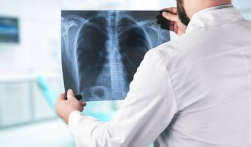 Nadciśnienie płucne – definicja i objawy