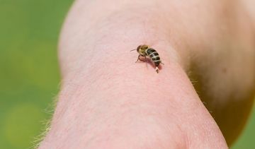 Użądlenie pszczoły – objawy alergii. Co robić gdy użądli pszczoła?