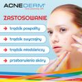 Acne-derm, krem przeciwtrądzikowy i wybielający, 20 g - 5908235400143