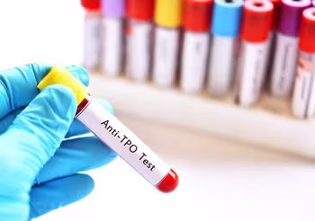 Przeciwciała anty-TPO bada się dla diagnozy chorób tarczycy o podłożu autoimmunologicznym.