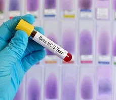 Gonadotropina kosmówkowa (beta hCG) – badanie, normy, wskazania, przygotowanie