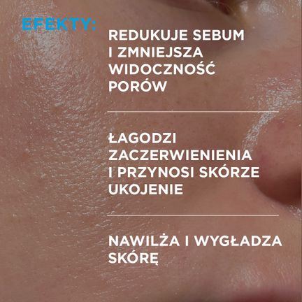 Idee Derm, krem na wypryski z kwasem salicylowym, 50 ml  - 5902082214779