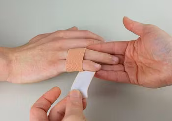 Wybity palec dłoni trzeba owinąć bandażem wraz ze zdrowym palcem i dodatkowym usztywnieniem opatrunku, np. długopisem, linijką. 