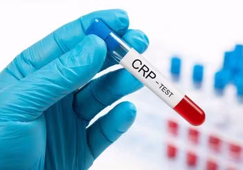 CRP bada się nie tylko przy podejrzeniu raka. Podwyższone wyniki mogą świadczyć na przykład o ostrym zapaleniu zatok przynosowych i błony śluzowej nosa.