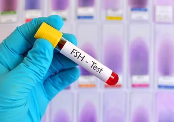 FSH, czyli folikulotropina lub hormon folikulotropowy jest wydzielany przez przedni płat przysadki mózgowej. Jego główną rolą jest pobudzenie jajników do syntezy estrogenów, co bezpośrednio wpływa na płodność u kobiet. /Fot. Adobe Stock