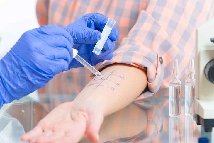lekarz wykonuje alergiczne testy skórne na przedramieniu pacjenta