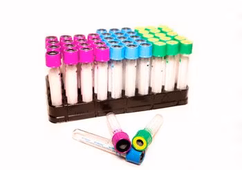 Hemoglobina zaliczana jest do jednych z podstawowych badań krwi żylnej. Jej poziom dostarcza lekarzowi wielu cennych informacji na temat ogólnego stanu zdrowia i jest pierwszym krokiem do postawienia rzetelnej diagnozy. /Fot. Adobe Stock