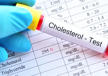 Wysokie stężenie cholesterolu wiąże się z ryzykiem powstawania tzw. złogów, które w konsekwencji prowadzą m.in. do rozwoju miażdżycy, grożącej zawałem serca. /Fot. Adobe Stock