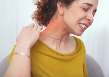 Pacjenci z uczuleniem na nikiel najczęściej zauważają u siebie wysypkę i świąd skóry w charakterystycznych miejscach na ciele, np. na szyi po kontakcie z biżuterią. Fot. Adobe Stock.